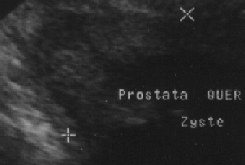 Ultraschall 2