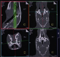 CT-Bildschirmanzeige 3D